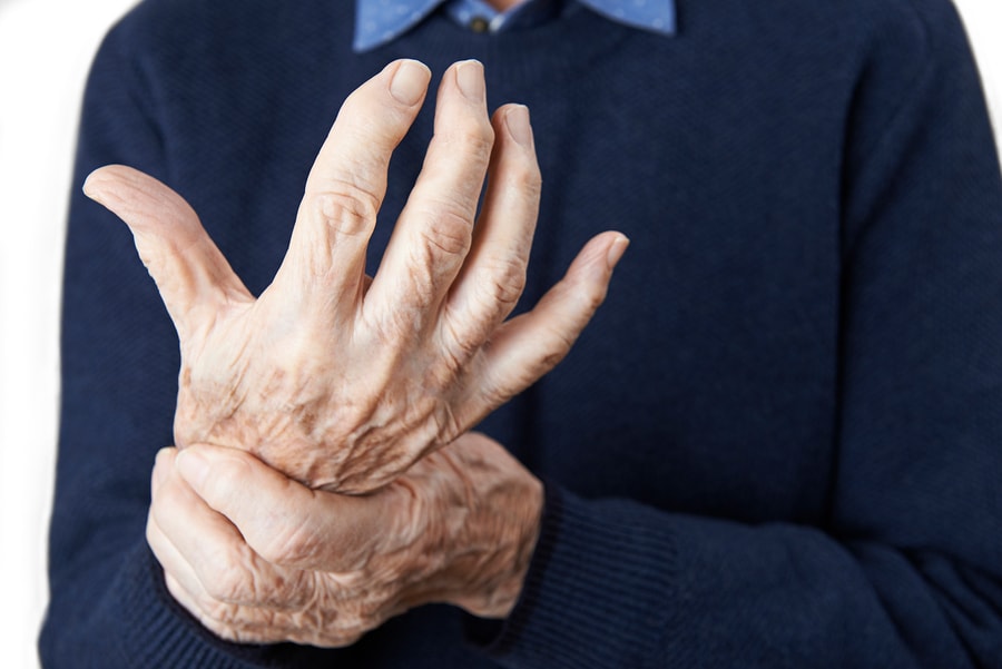 arthritis in hands